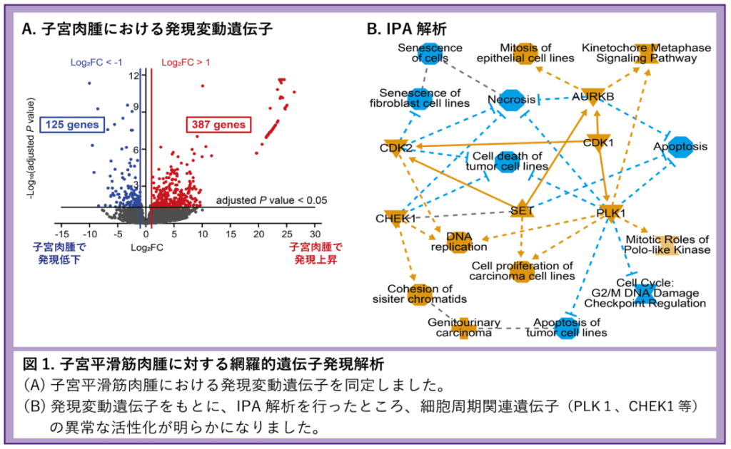 子宮平滑筋肉腫の新たな治療標的遺伝子を同定、PLK1阻害剤/CHEK1阻害剤に期待