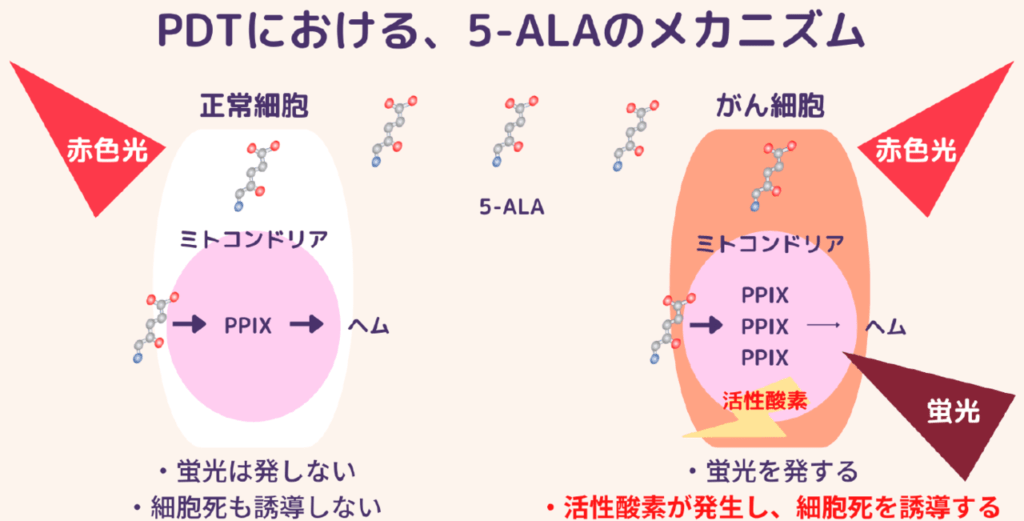 子宮頸部上皮内腫瘍に対する光線力学的療法の臨床試験実施へ、クラウドファンディングを開始